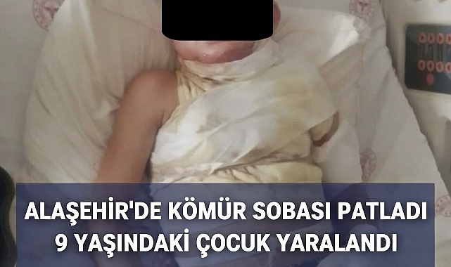 Alaşehir'de 7 Kişilik Ailenin Yaşadığı Evde Kömür Sobası Patladı: Yangında 9 Yaşındaki Çocuk Yaralandı
