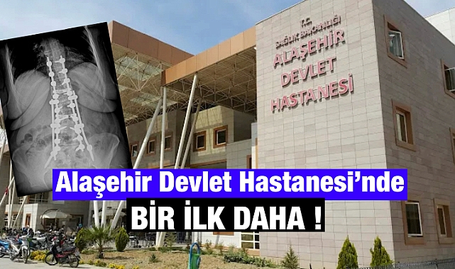 Alaşehir Devlet Hastanesi'nde Bir İlk: Skolyoz Ameliyatı Başarıyla Yapıldı