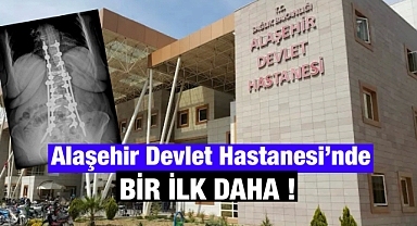 Alaşehir Devlet Hastanesi'nde Bir İlk: Skolyoz Ameliyatı Başarıyla Yapıldı